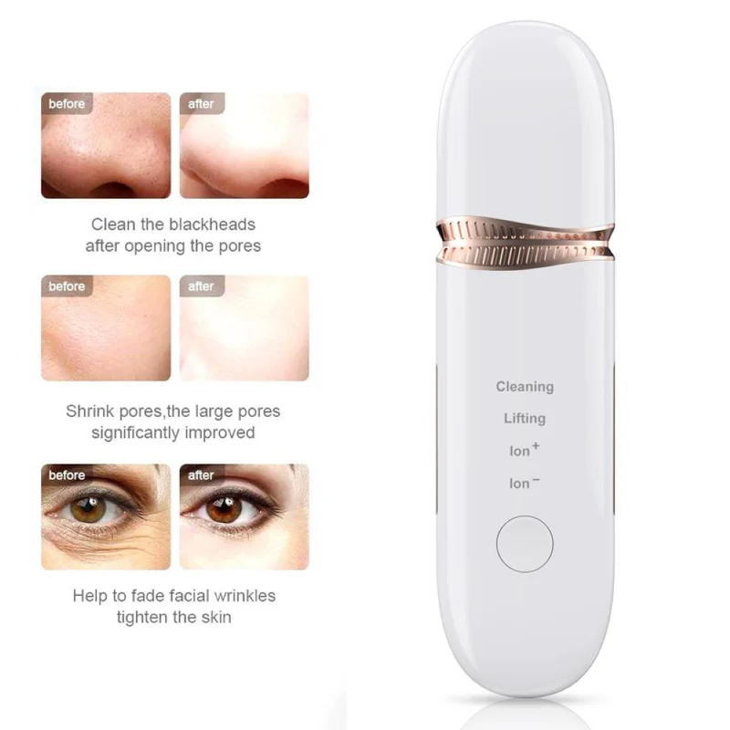 Spatule ultrasonique ionique professionnelle pour le nettoyage du visage (épurateur de peau/skin scrubber)