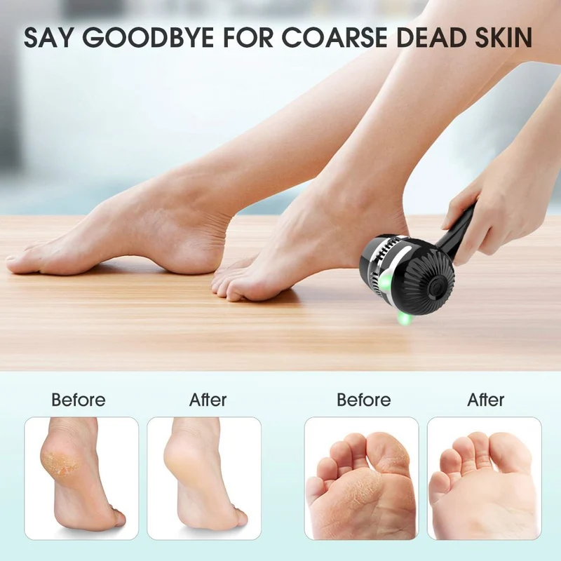 Appareil électrique de soins des pieds